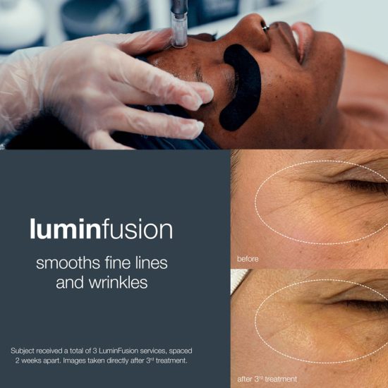 Lumifusion 赛车游戏攻略 线上直播一分钟极速の赛车结果+官网记录全年历史号75秒